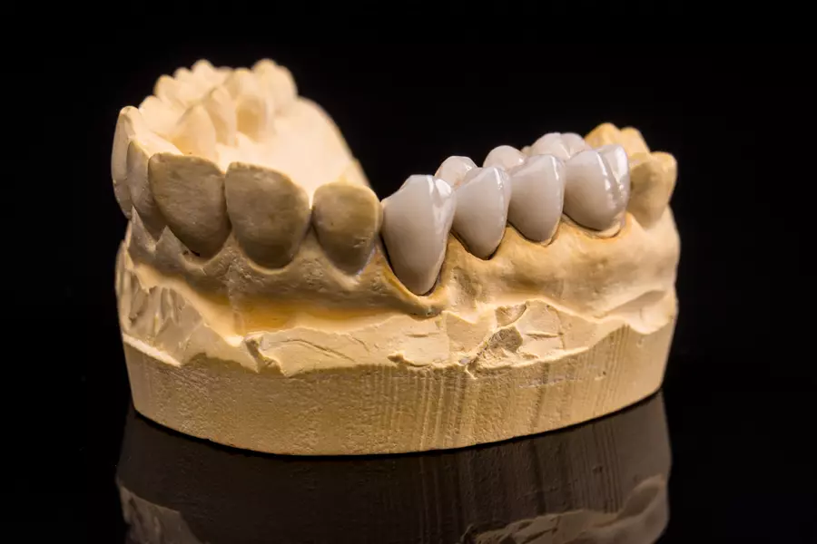 false-teeth-2026-01-08-05-40-32-utc.webp